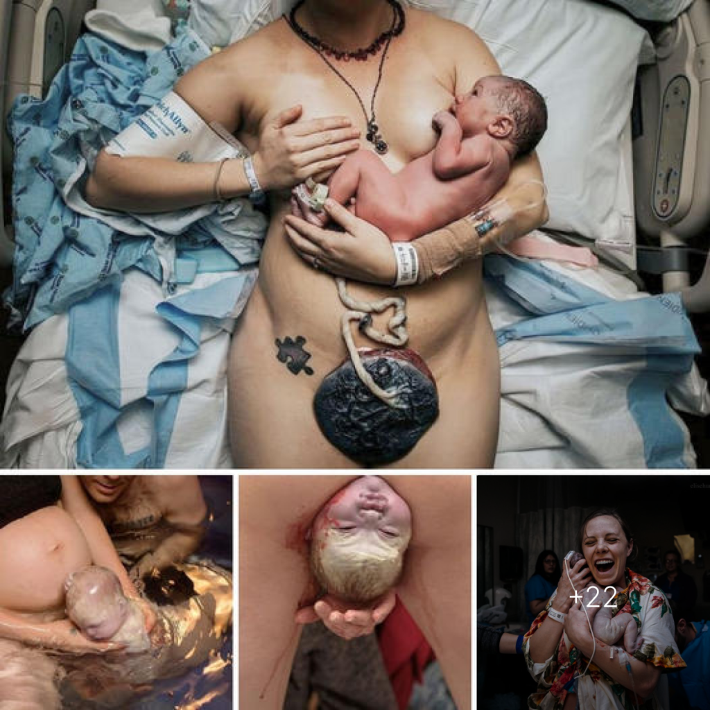 Captivating Moments of Childbirth That Have Taken the Internet by Storm ‎-ltbl