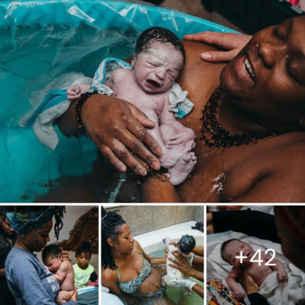 Immerse Yourself in the Magical World of Water Births: 45 Breathtaking Photos -ltbl