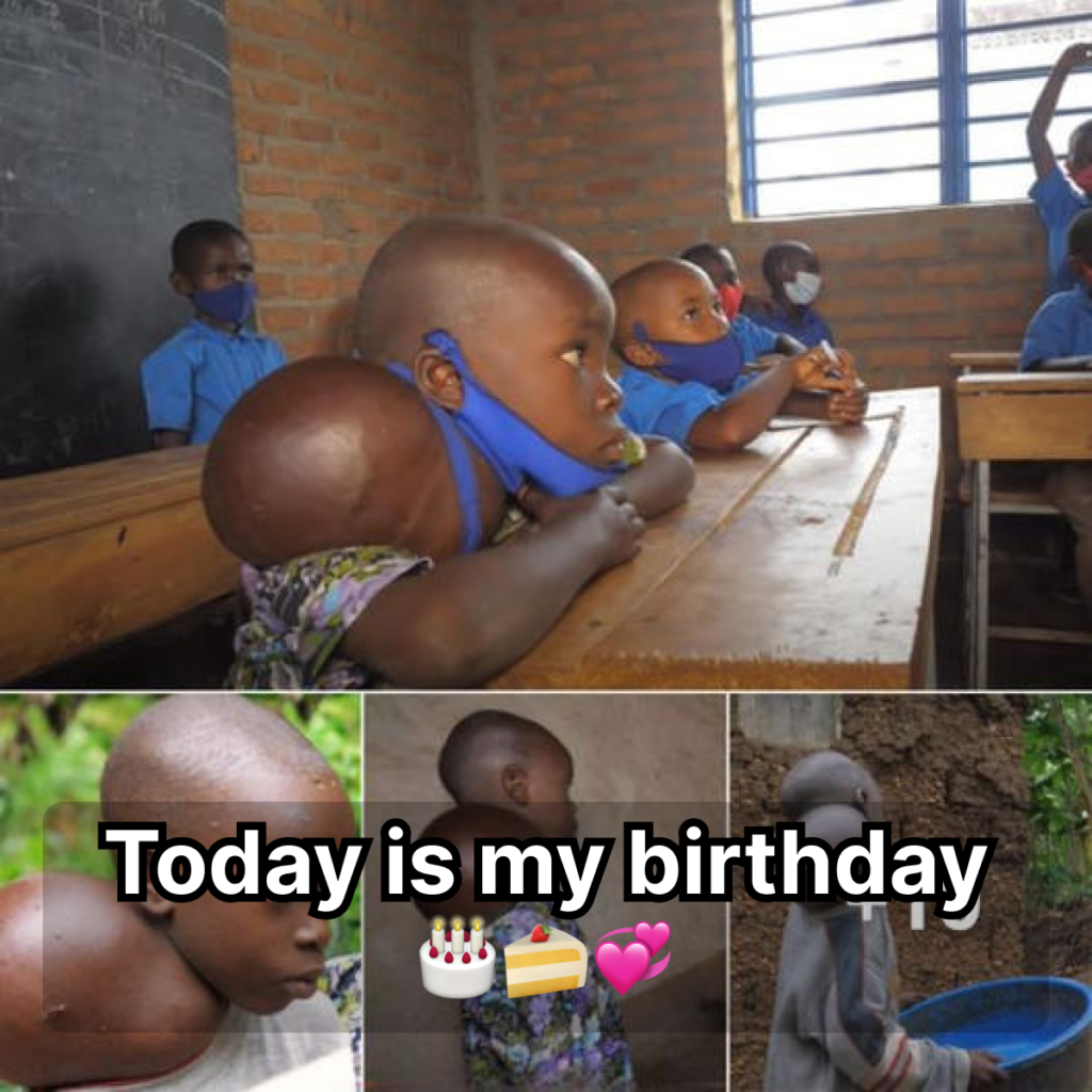 They Call Me A Boy With 2 Heads : EXTRAORDINARY PEOPLE-dubi