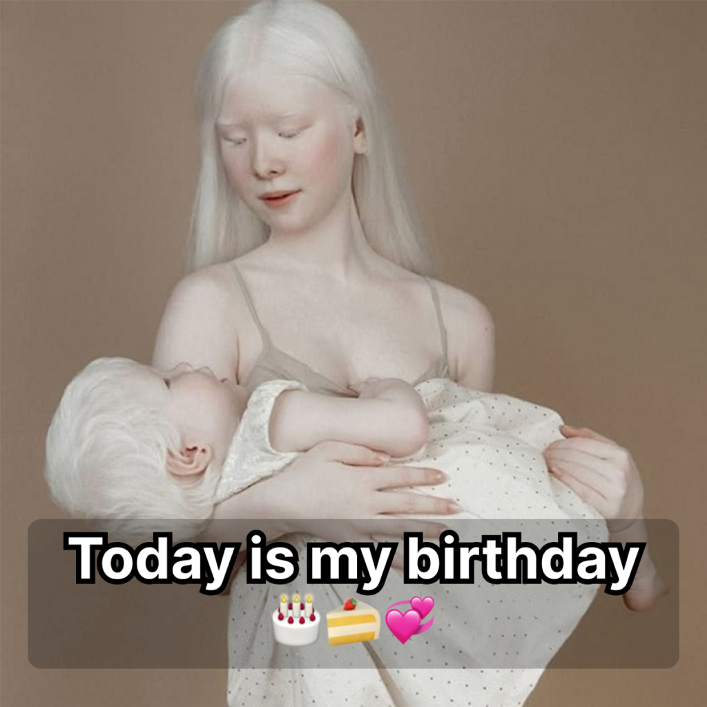 ! Two stunning albino sisters, Asel and Kamila Kalaganova, were born into the same family twelve years apart.