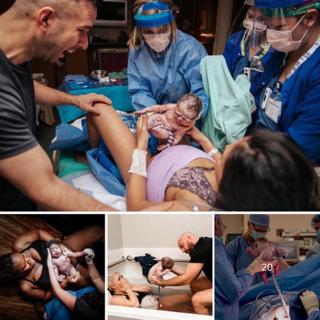 Breathtaking Birth Photography Moments That Will Leave You in Awe -ltbl